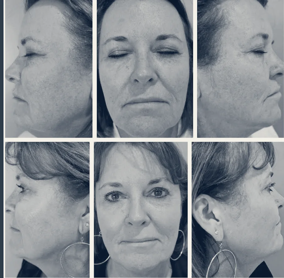 MySkin Medical Spa — Costa Mesa, California