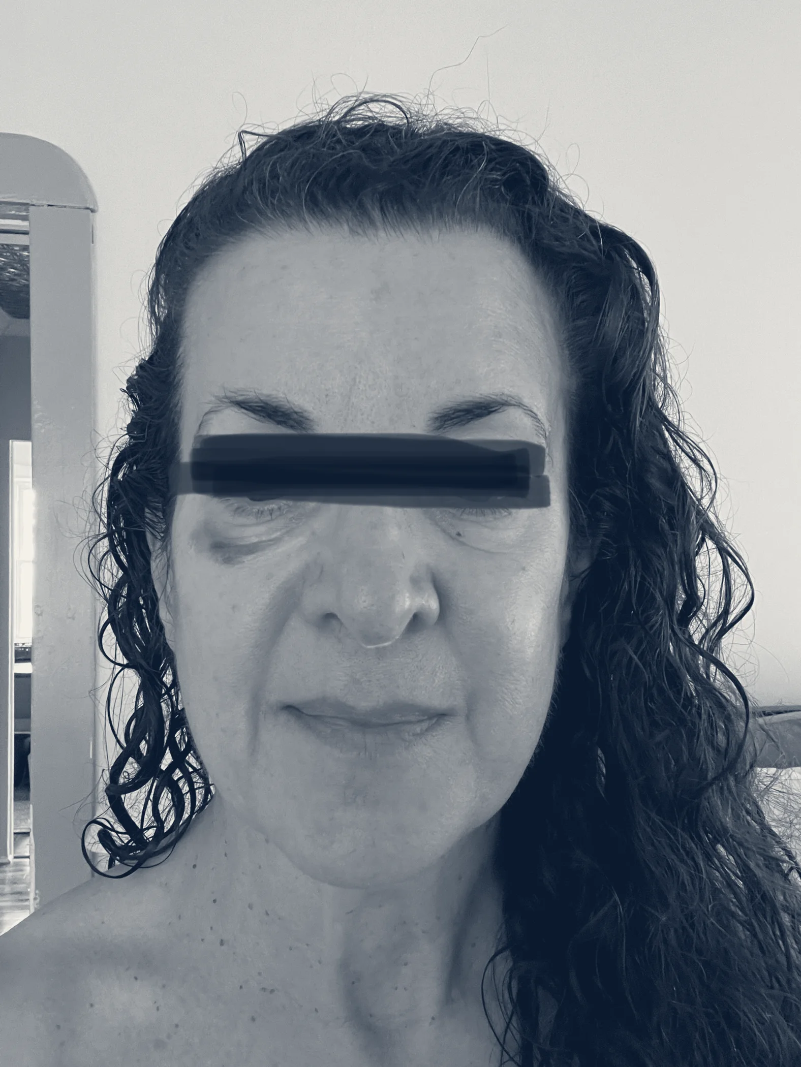 Peak Medical Spa — Haddonfield, New Jersey