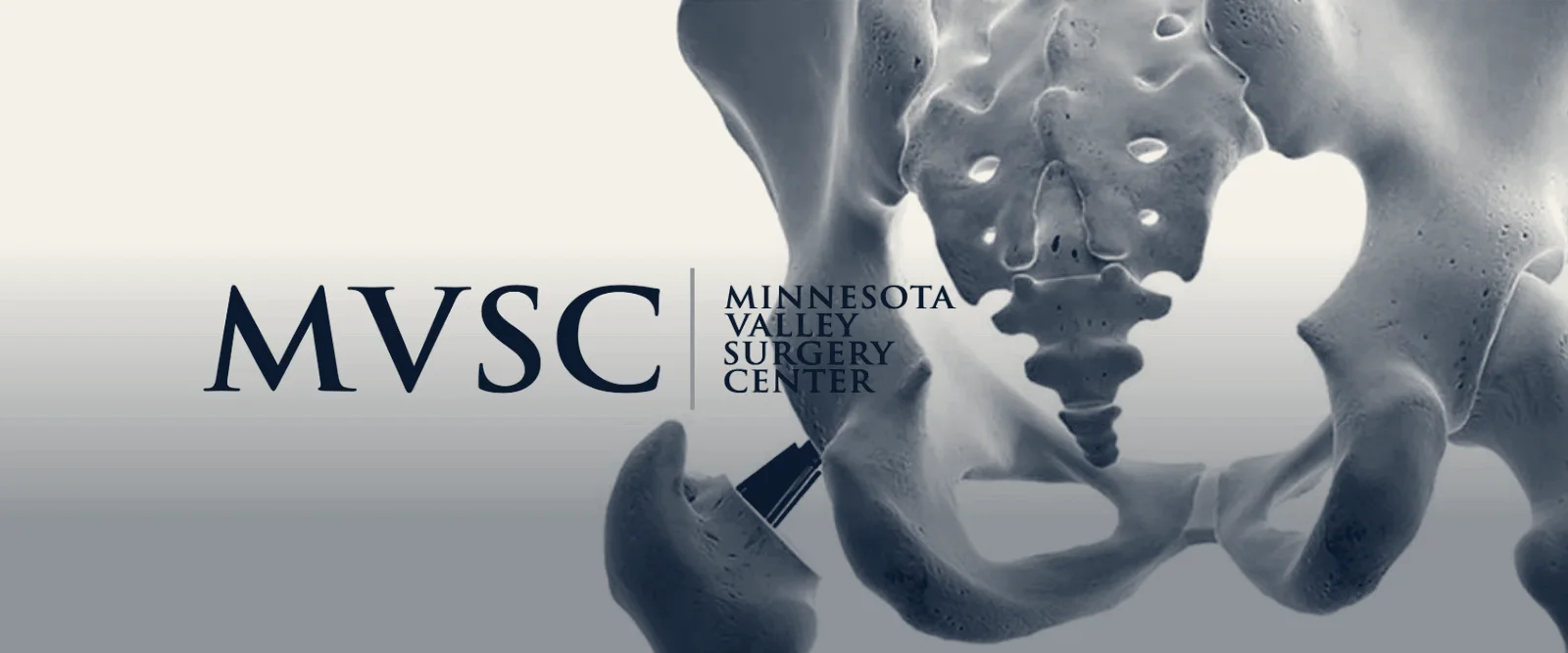 Minnesota Valley Surgery Center — Burnsville, Minnesota