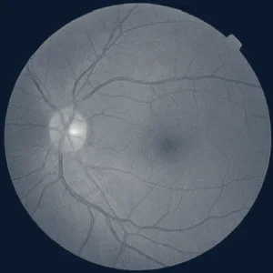 Galanis Cataract & Laser Center — St. Louis, Missouri