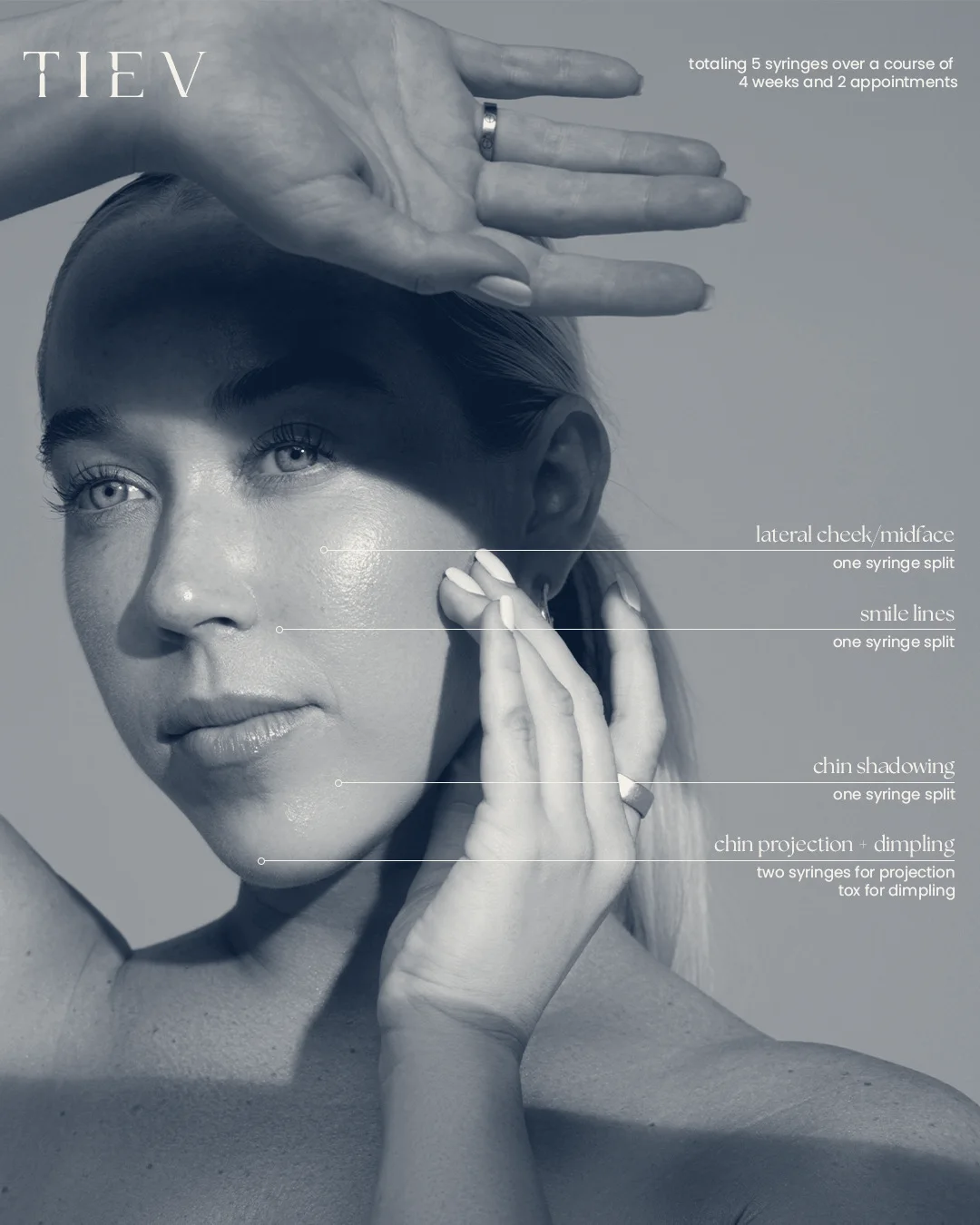 TIEV Medspa — Costa Mesa, California