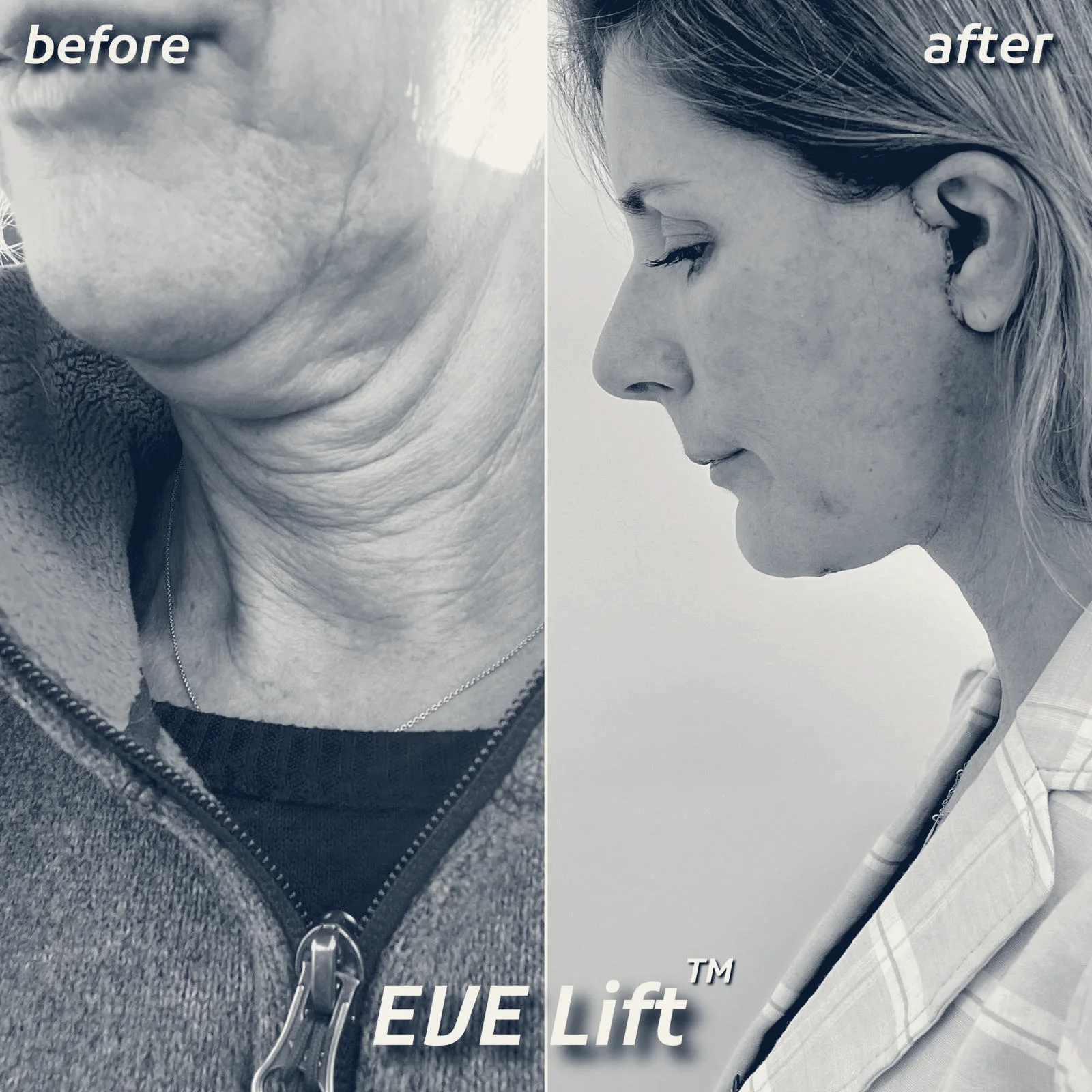 Eden Plastic Surgery: Ali Charafeddine, MD — Miami, Florida