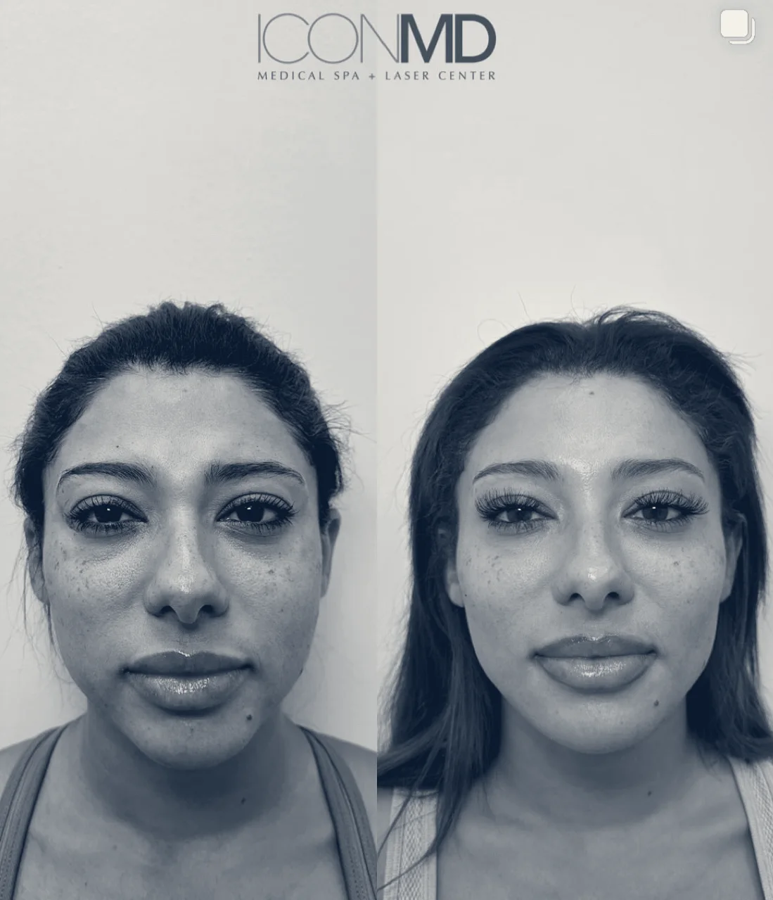 Icon MD Medical Spa + Laser Center Boca Raton — Boca Raton, Florida