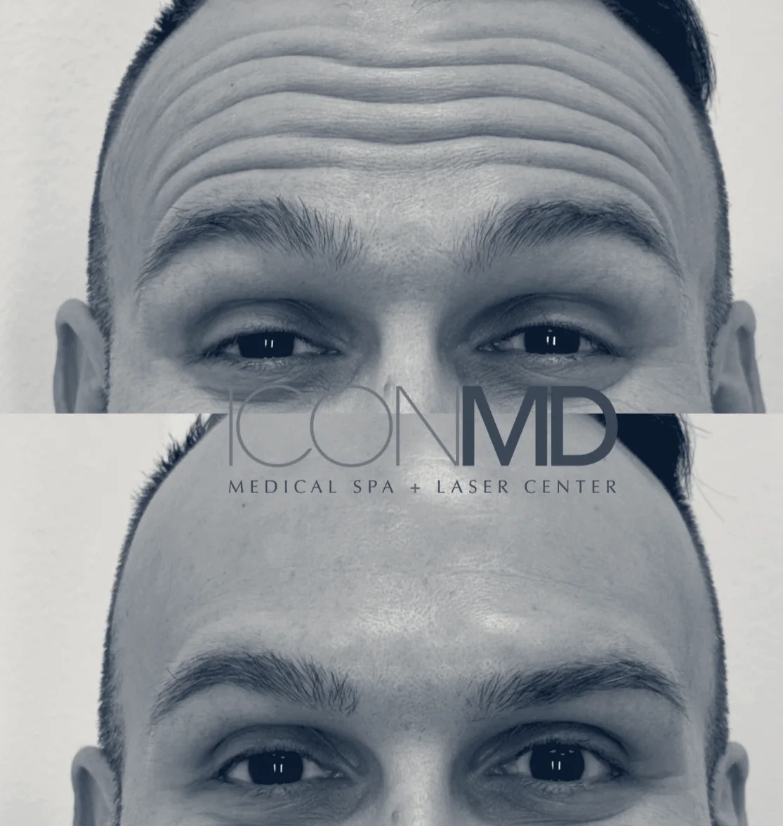 Icon MD Medical Spa + Laser Center Boca Raton — Boca Raton, Florida