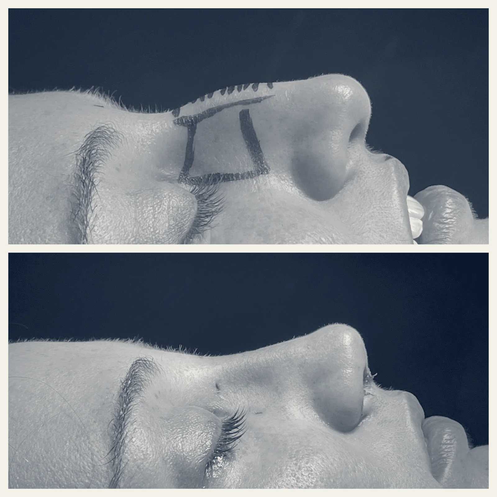 Steiger Facial Plastic Surgery: Dr. Jacob D. Steiger — Boca Raton, Florida