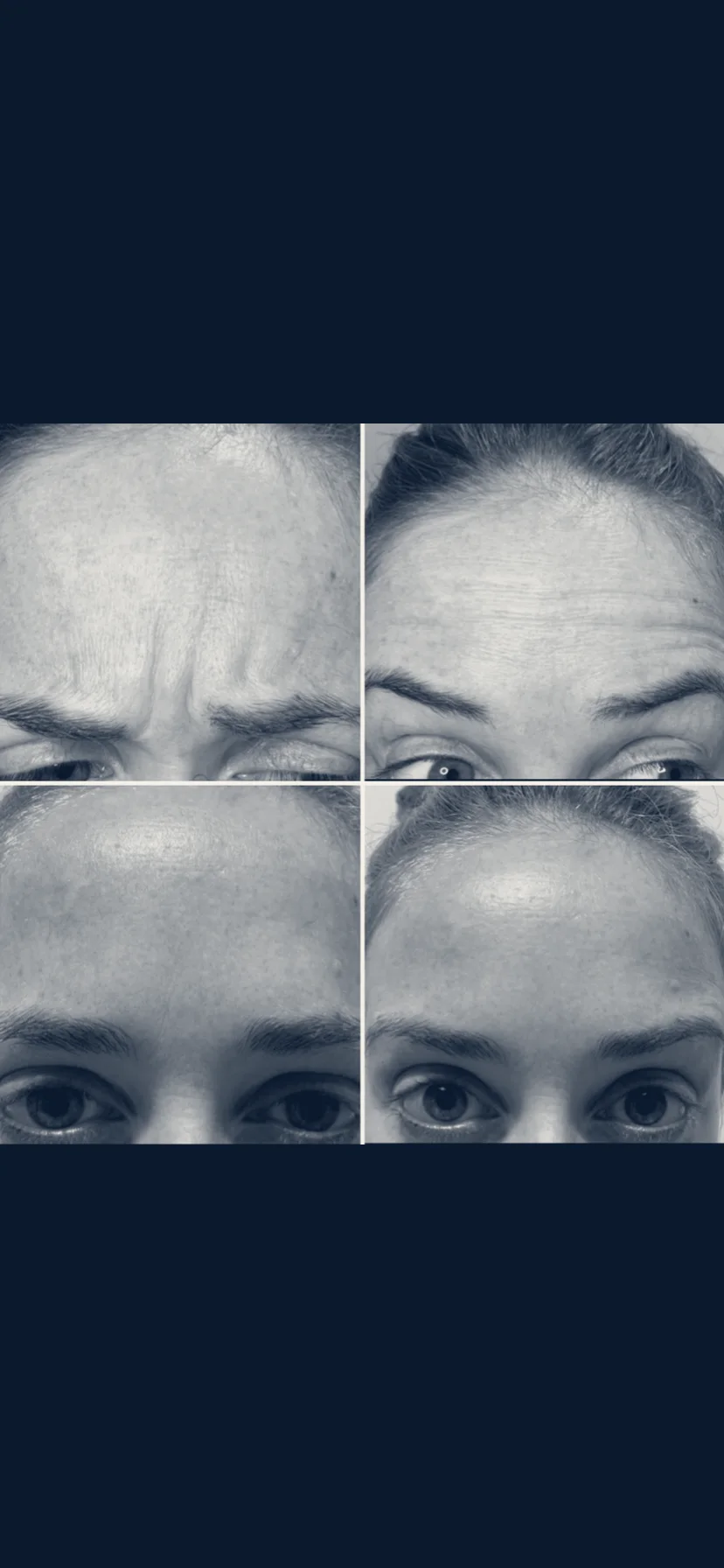 AlluraMD Aesthetics + Wellness | Boynton Beach — Boynton Beach, Florida