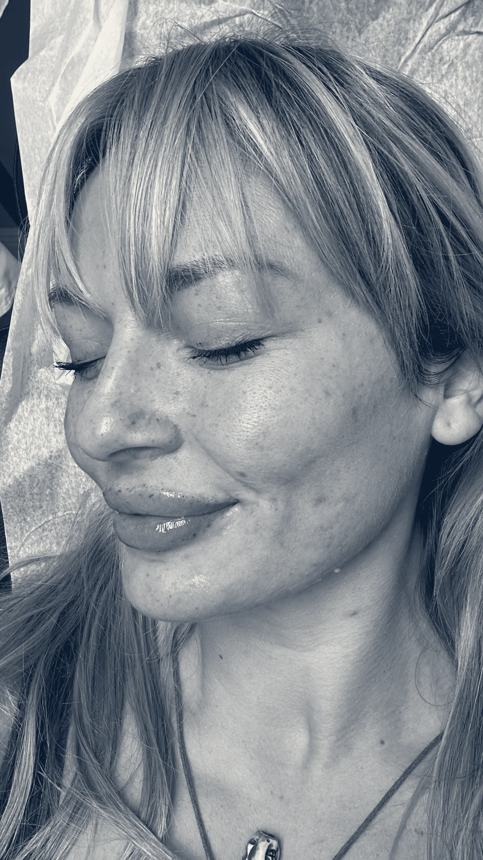 VIP Aesthetic Center Best Med Spa for Botox & Fillers — Hallandale Beach, Florida