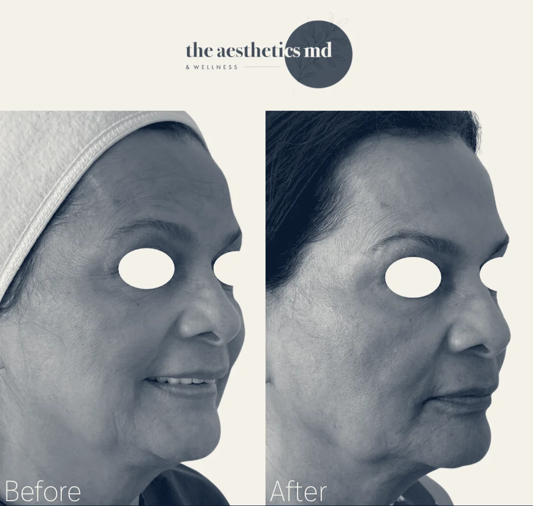 The Aesthetics MD & Wellness — Coral Gables, Florida