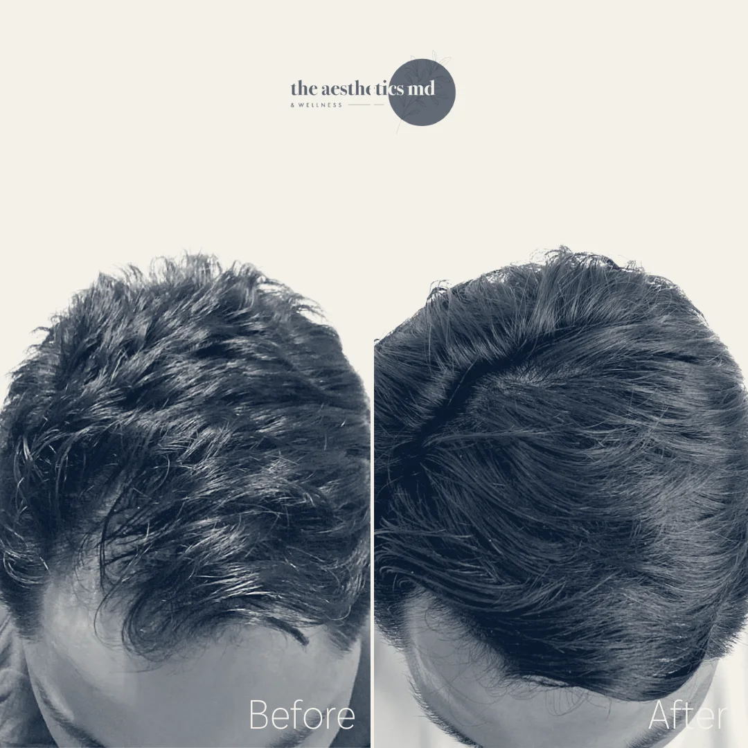 The Aesthetics MD & Wellness — Coral Gables, Florida