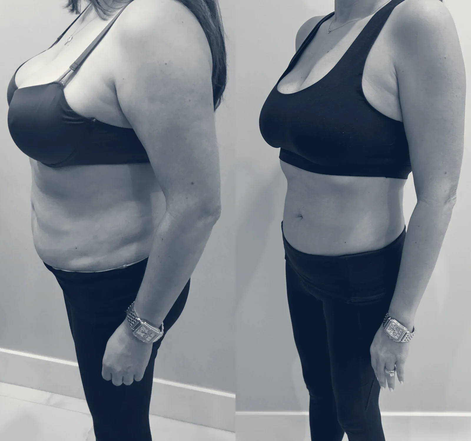 Vanity Point & Wellness — Coral Gables, Florida