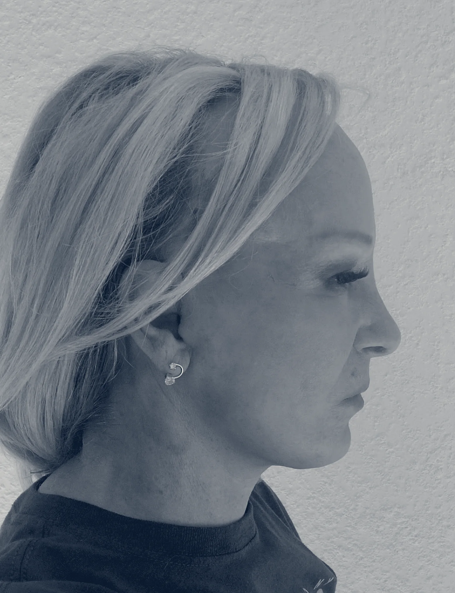 Rivera Plastic Surgery — Miami Beach, Florida
