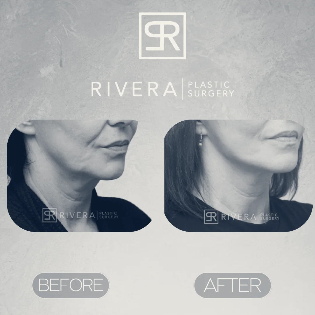 Rivera Plastic Surgery — Miami Beach, Florida