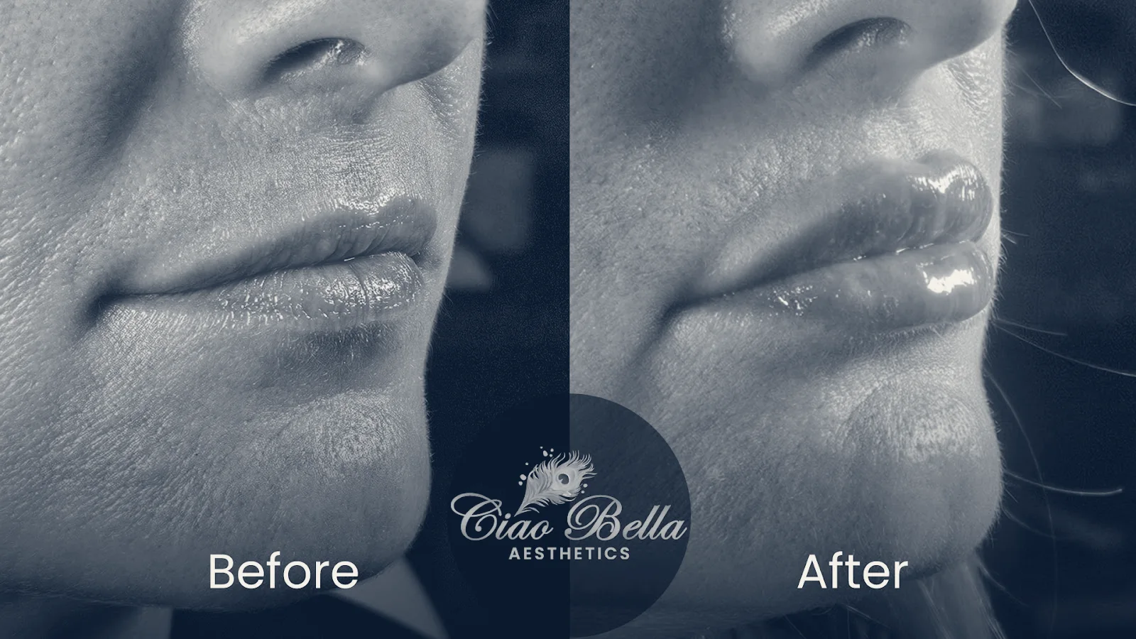 Ciao Bella Aesthetics — Lake Forest, California