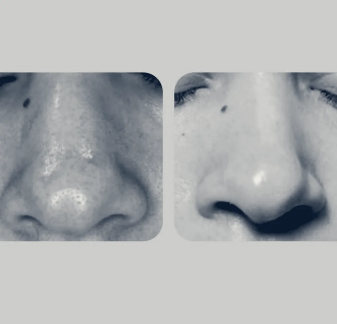 The Skin Studio by Johanna — Coral Springs, Florida