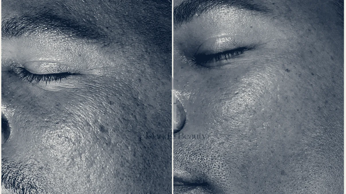 Island of Beauty Facial Spa Miramar — Miramar, Florida