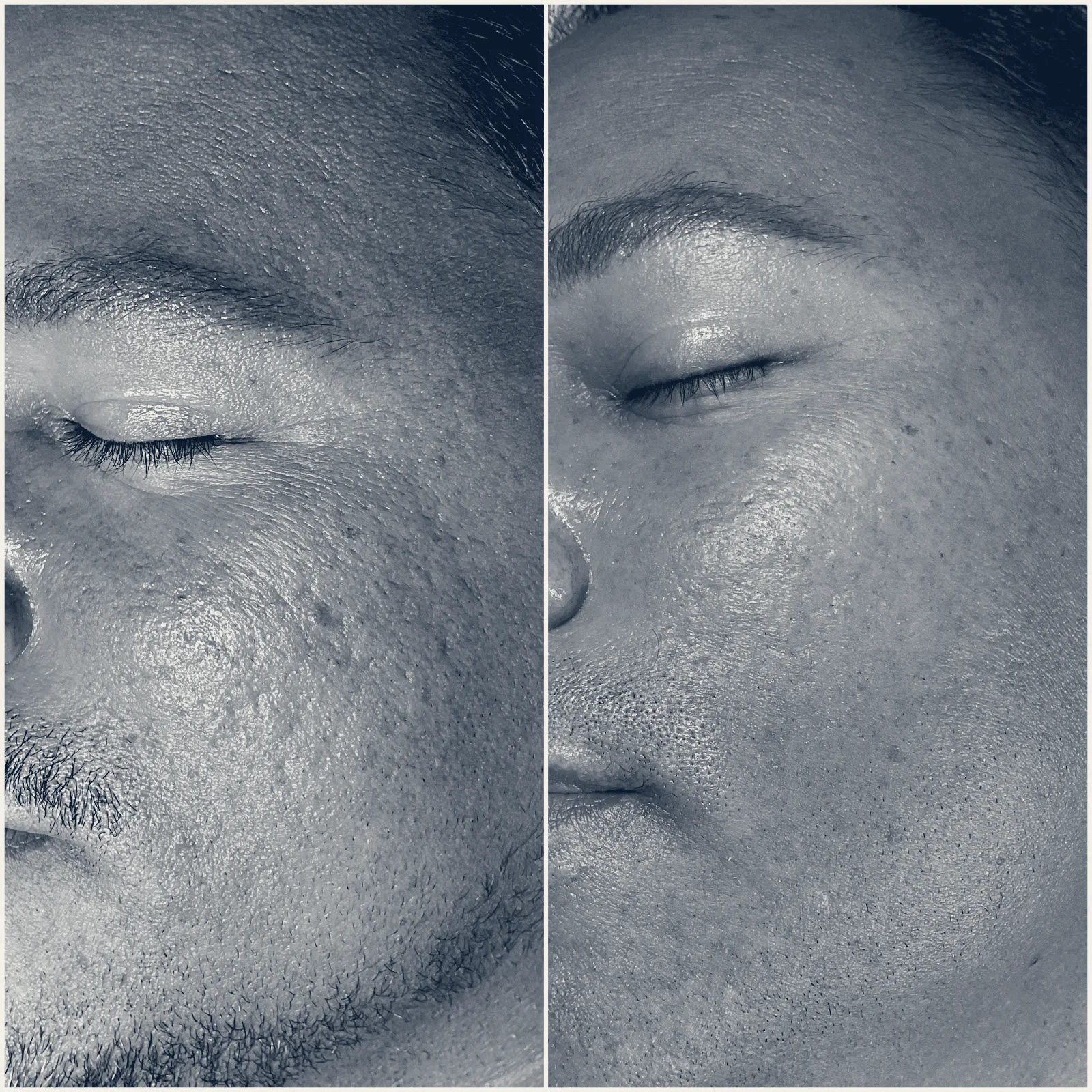 Island of Beauty Facial Spa Miramar — Miramar, Florida