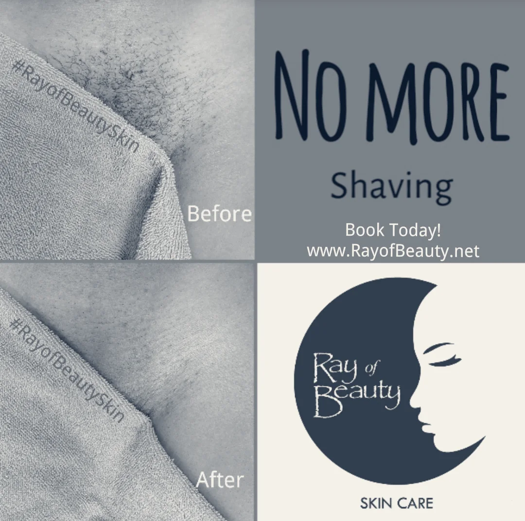 Ray of Beauty Skincare — Lauderdale Lakes, Florida