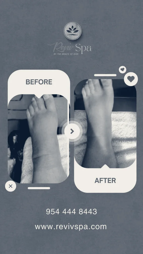 Reviv Spa Post Operative / Lipo After Care - Lymphatic Drainage Care Center — Fort Lauderdale, Florida