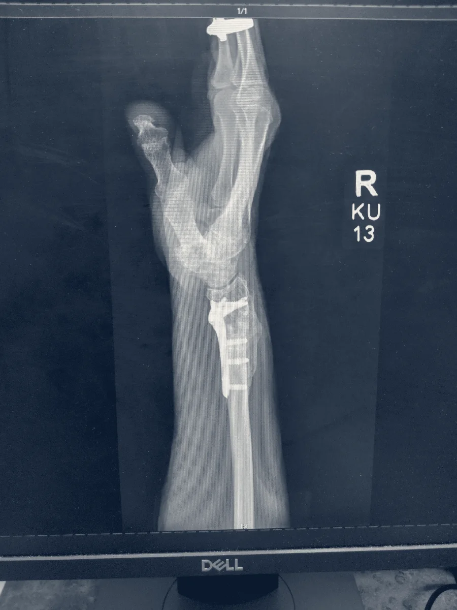 Florida Orthopaedic Institute — Brandon, Florida