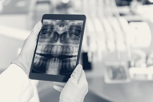 YJ OMS Dental Implants & Oral Surgery — Placentia, California