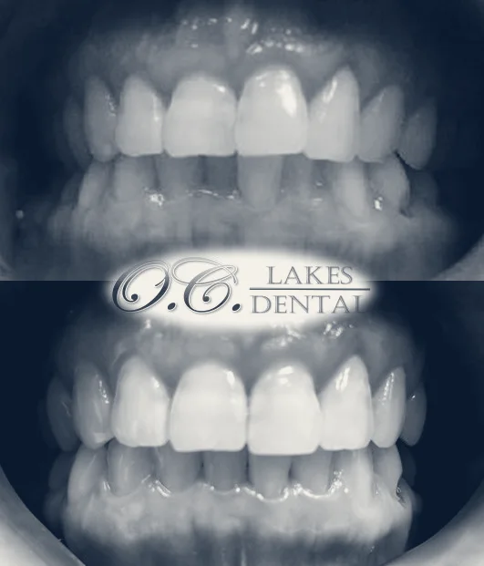 OC Lakes Dental — Irvine, California