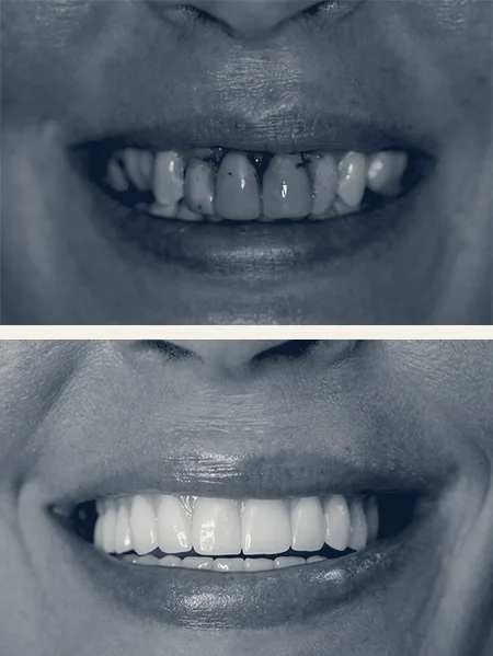 4M Dental Implant Center — Long Beach, California