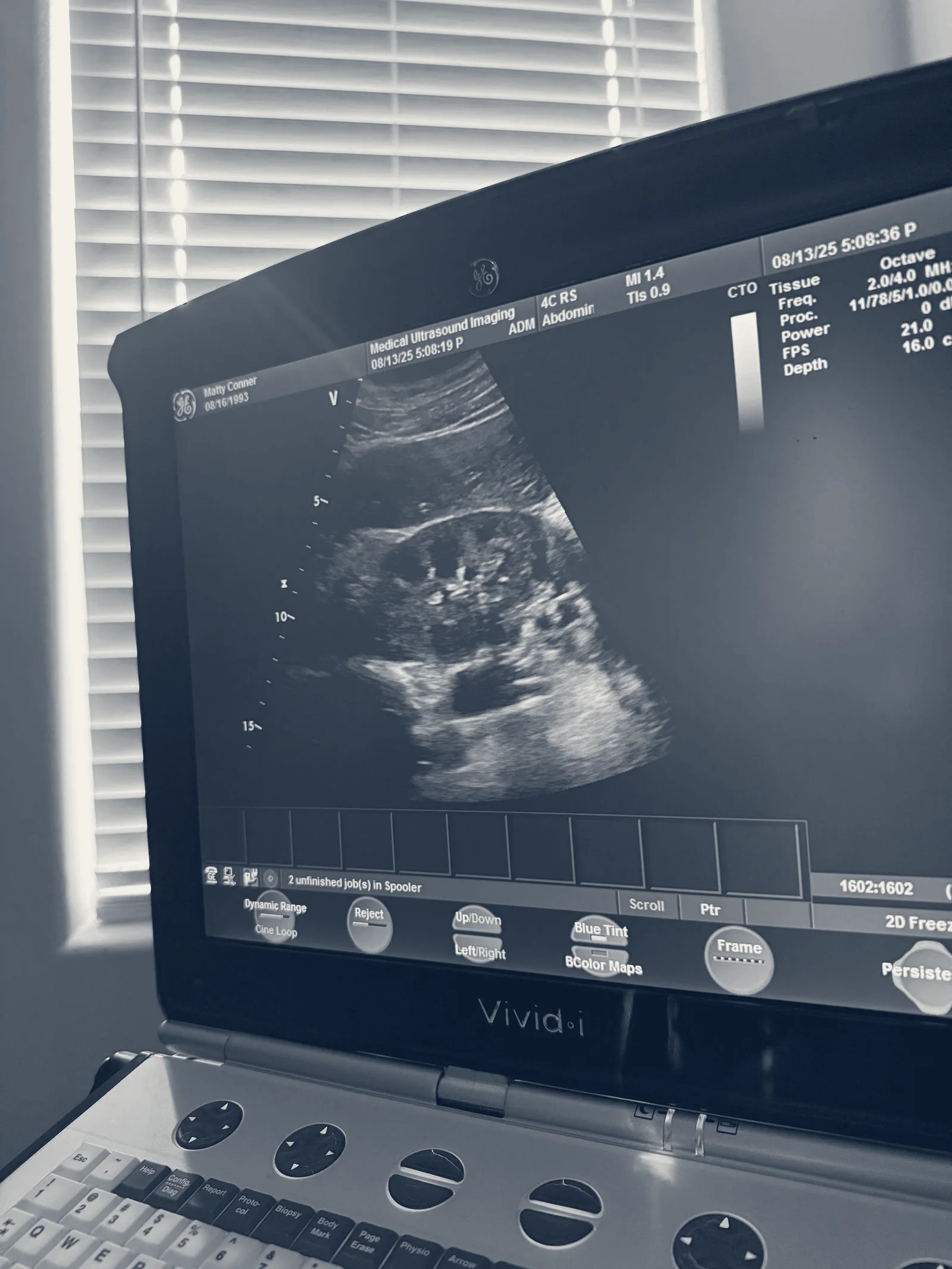Medical Ultrasound Imaging — Las Vegas, Nevada