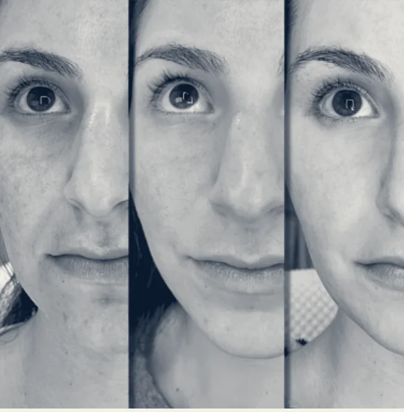 Collagen Bar NYC Microneedling, Laser Facials, Hair Restore and Body Contouring — New York, New York