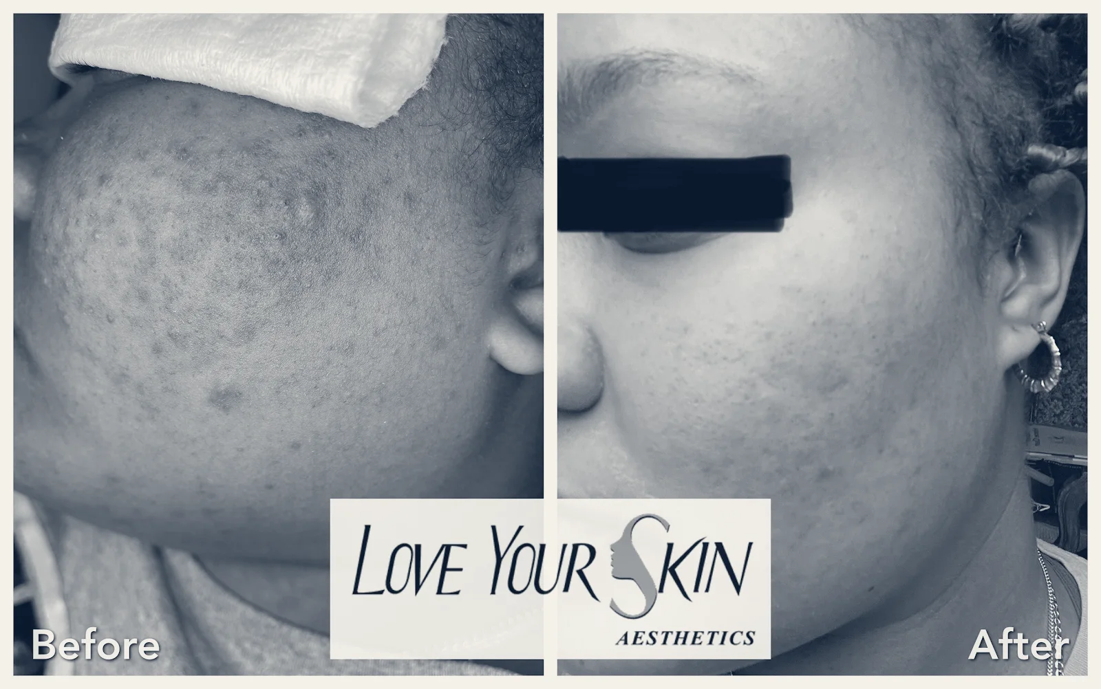 Love Your Skin Aesthetics — Artesia, California
