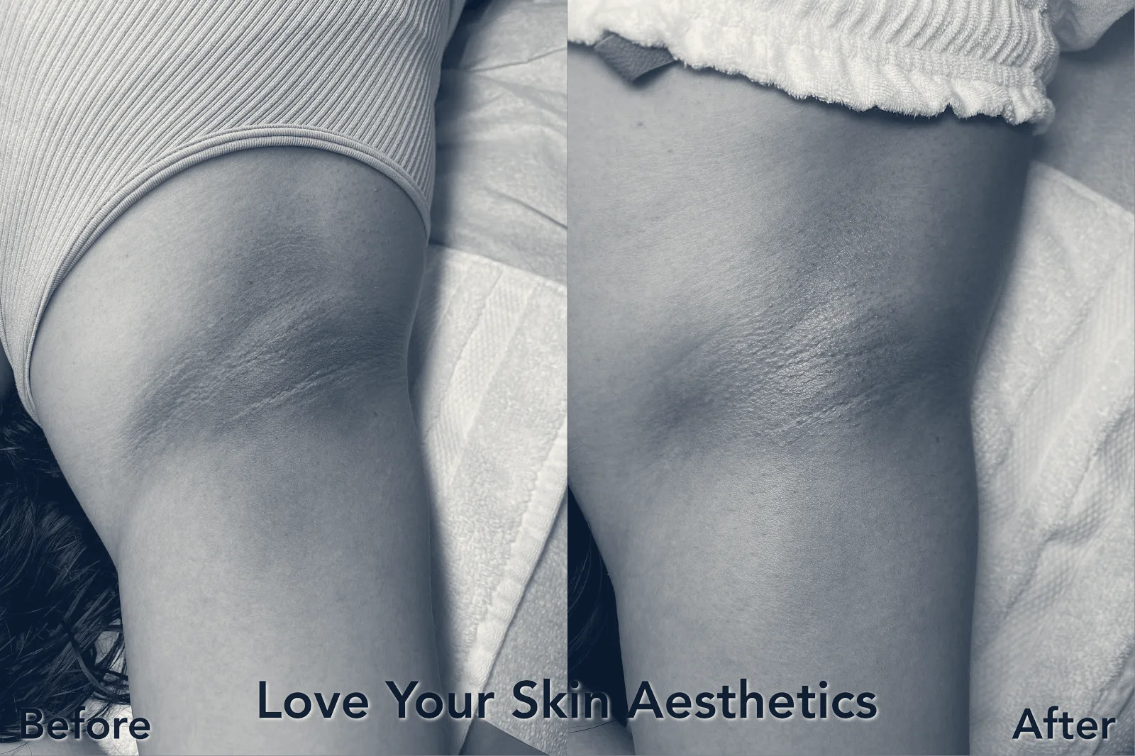 Love Your Skin Aesthetics — Artesia, California