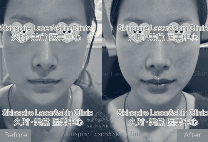 Skinspire Laser&Skin Clinic 久时美黛医美中心 - Irvine — Irvine, California
