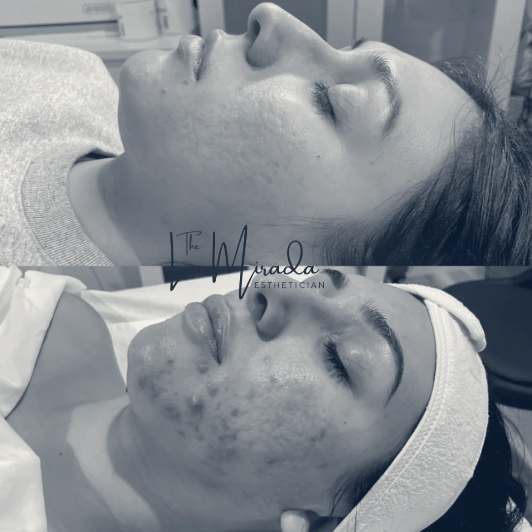 The La Mirada Esthetician - Facials + Brazilian Sugaring — La Mirada, California