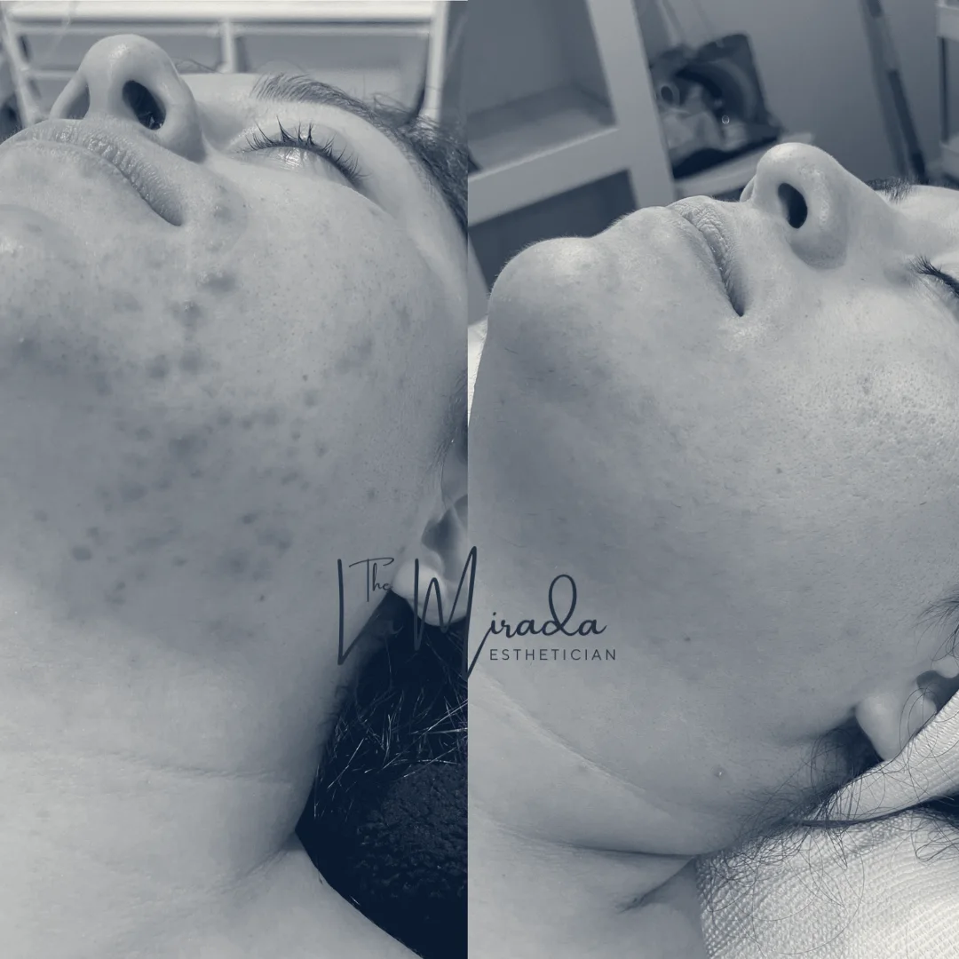 The La Mirada Esthetician - Facials + Brazilian Sugaring — La Mirada, California