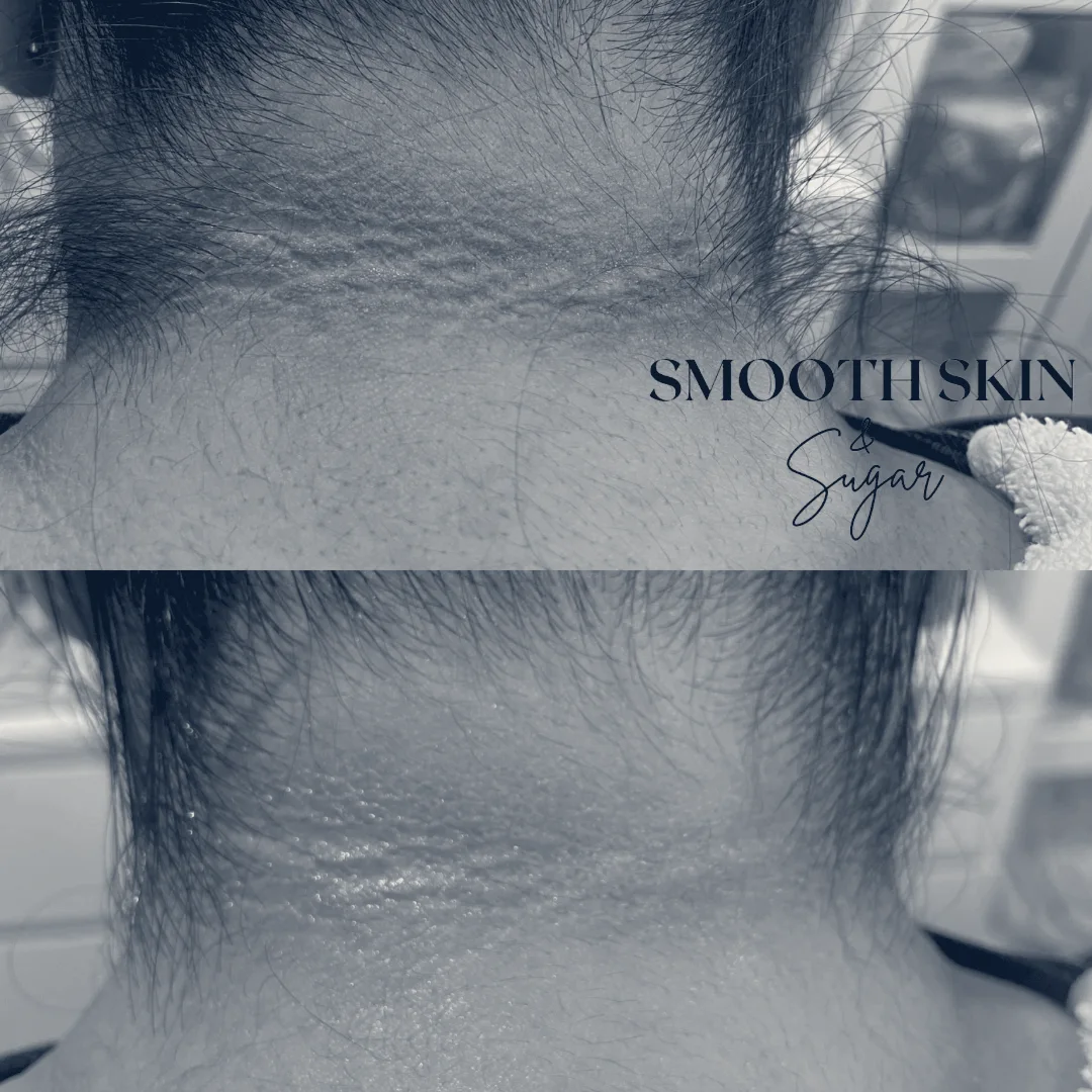 The La Mirada Esthetician - Facials + Brazilian Sugaring — La Mirada, California