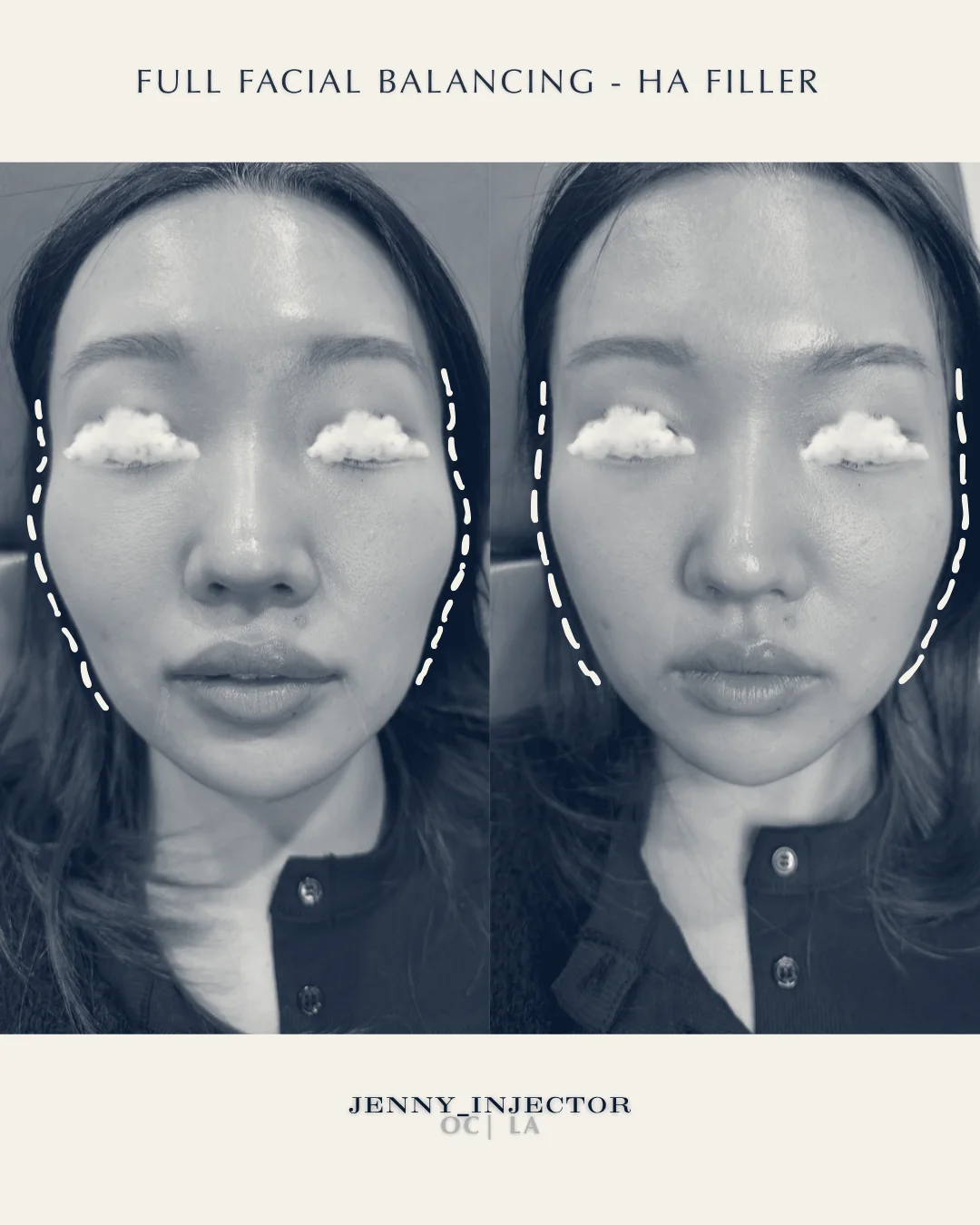 Roena Medspa (formerly Jeune Medspa Cerritos) — Cerritos, California