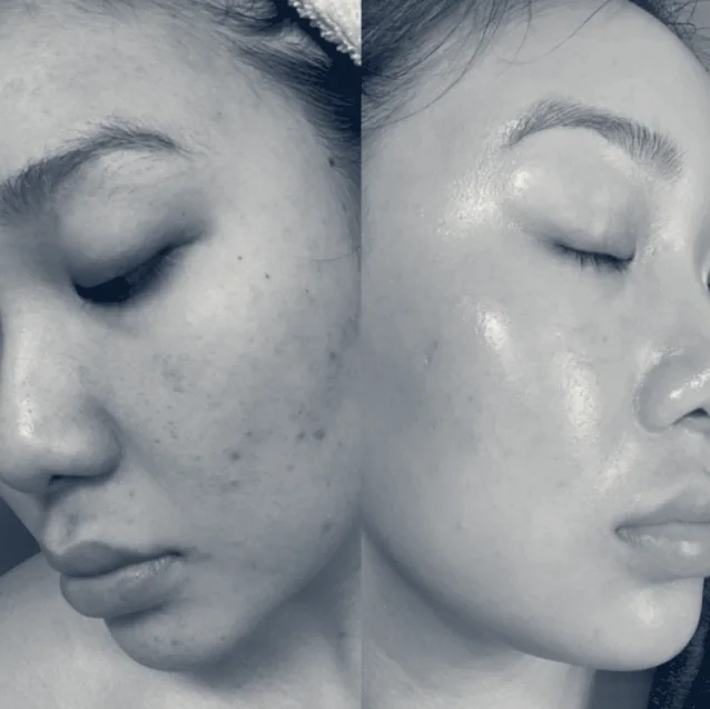 SKIN BAR — Cerritos, California