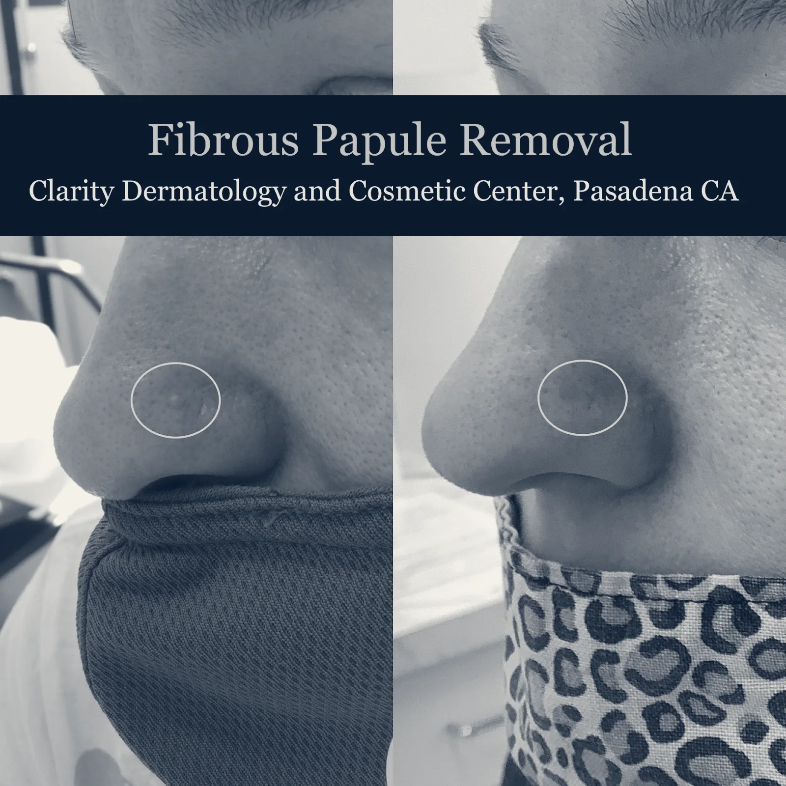 Clarity Dermatology and Cosmetic Center — Pasadena, California
