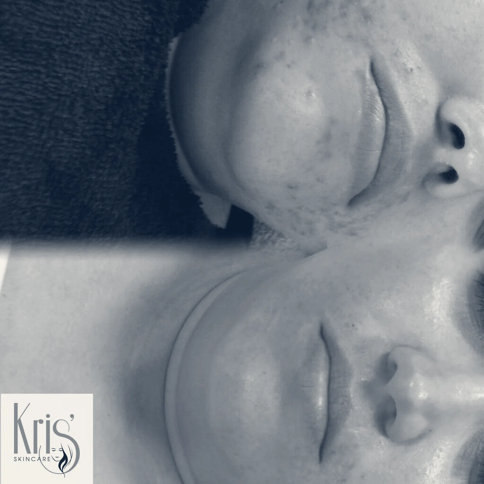 Kris' Skincare — Moses Lake, Washington