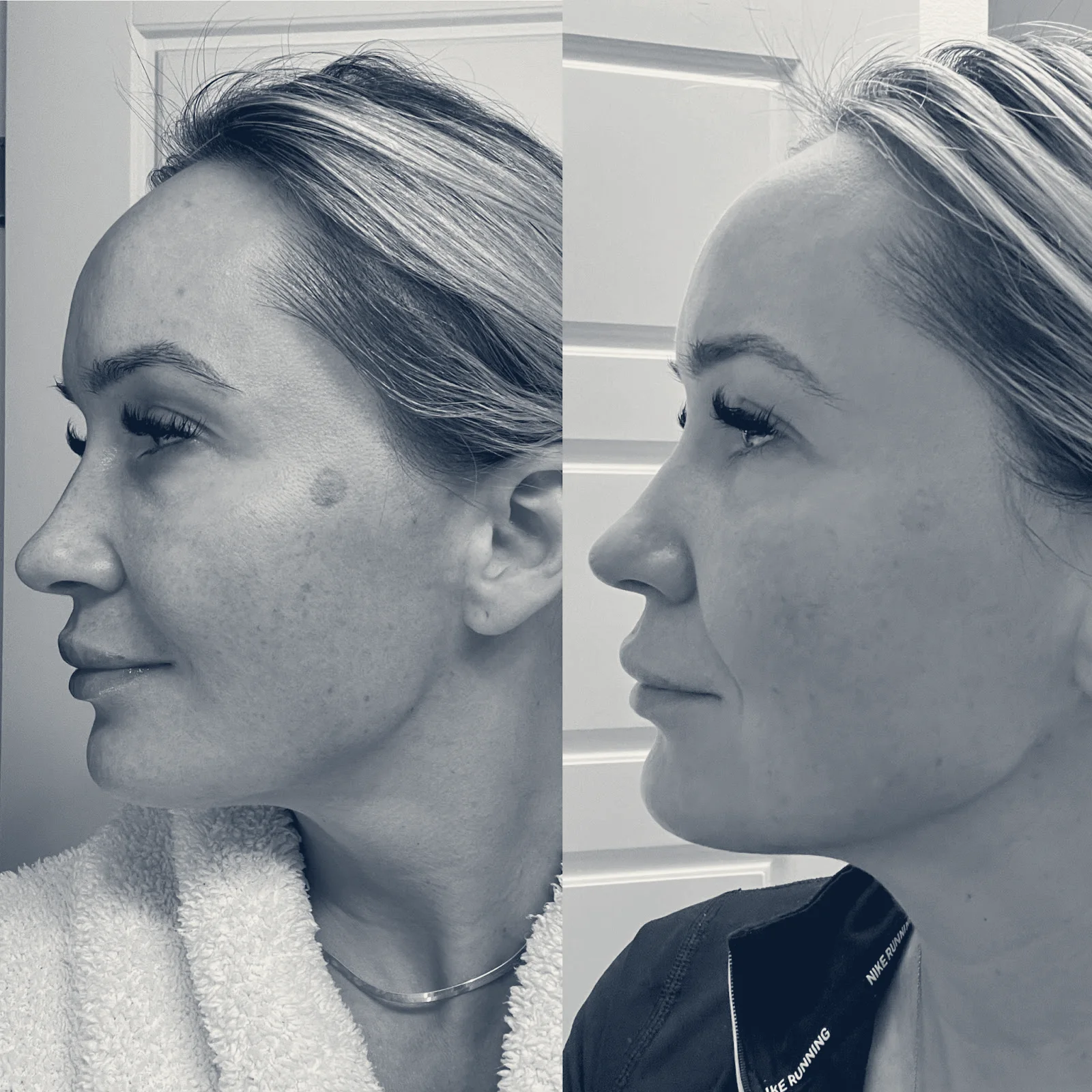 Aesthetics with Yelena — Milton, Washington