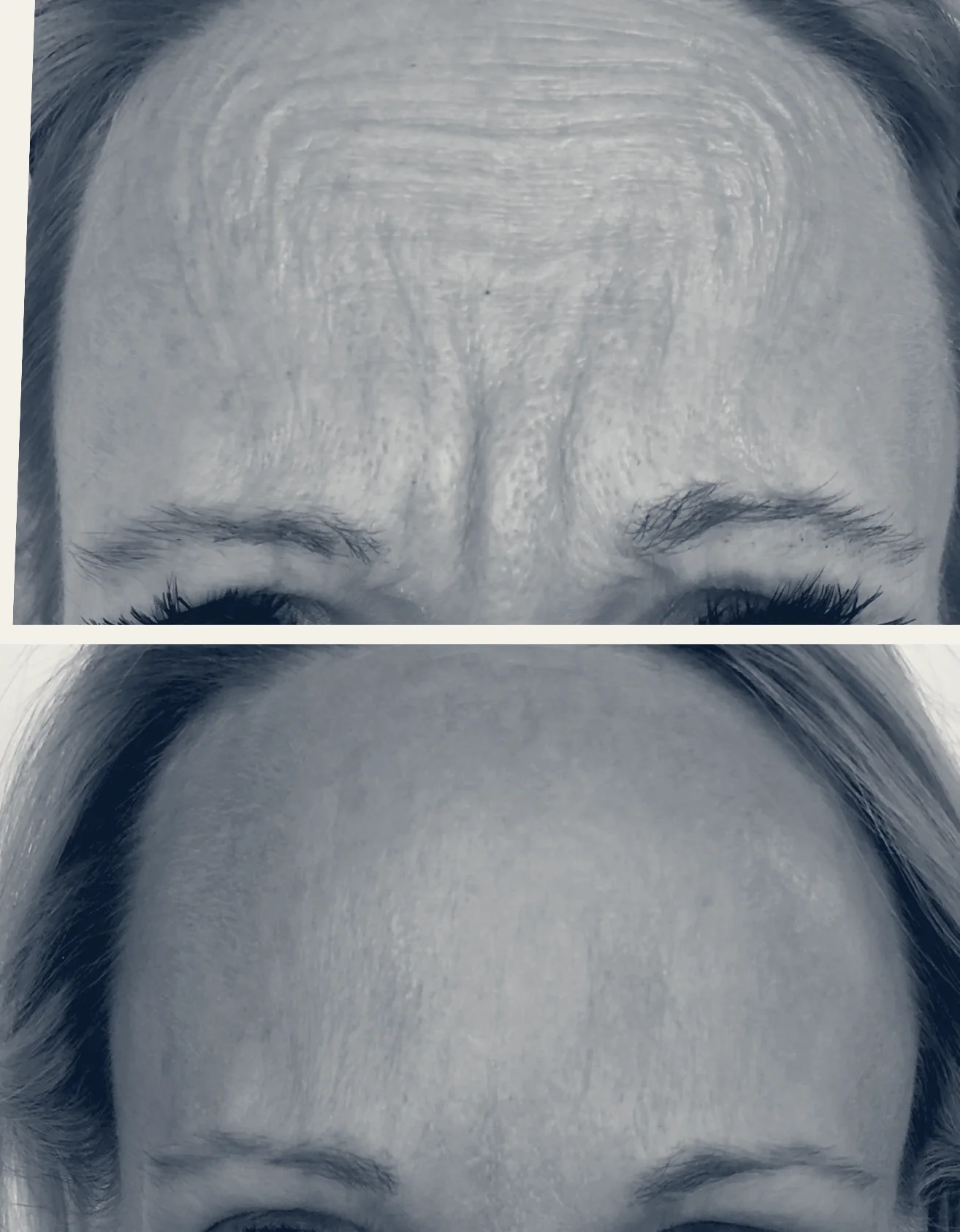 Metamorphosis Holistic MedSpa, PLLC — Issaquah, Washington