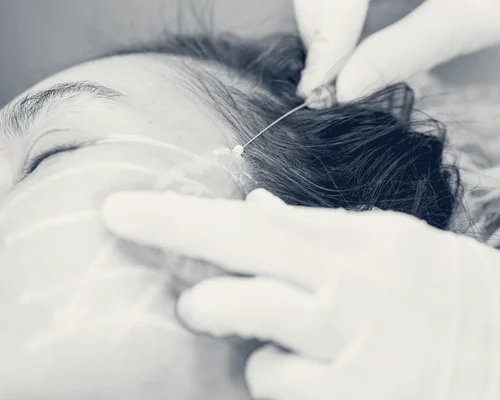 Ageaway Medical Spa — Great Neck, New York