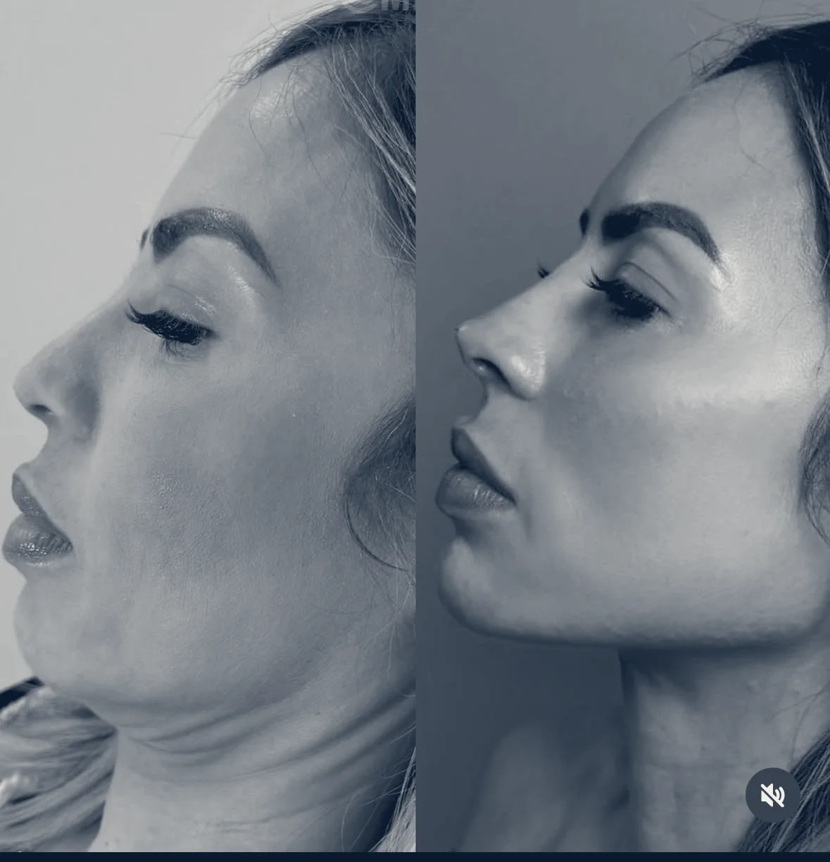 Jen's Beauty | PA Wellness PLLC Medspa — Flushing, New York