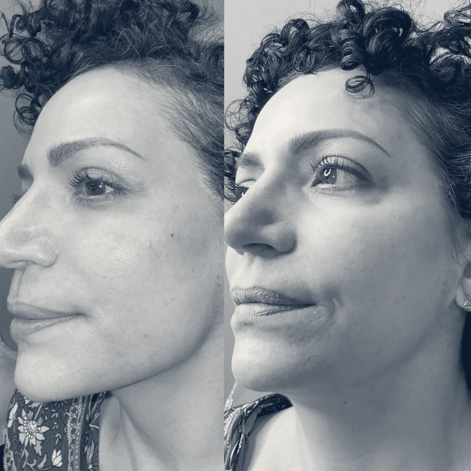 Jen's Beauty | PA Wellness PLLC Medspa — Flushing, New York