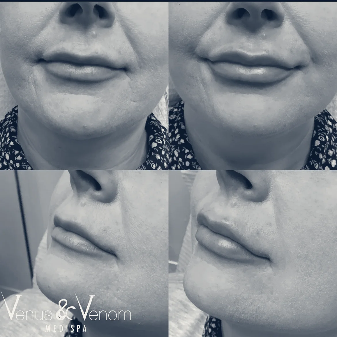 Venus & Venom MEDIspa Monroe — Monroe, New York