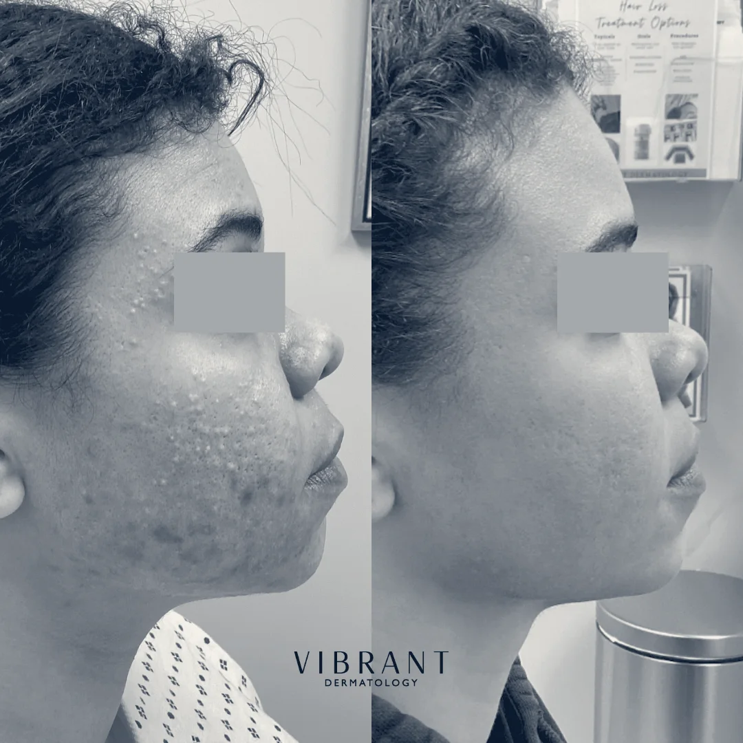 Vibrant Dermatology & Aesthetics - Milton — Milton, Massachusetts