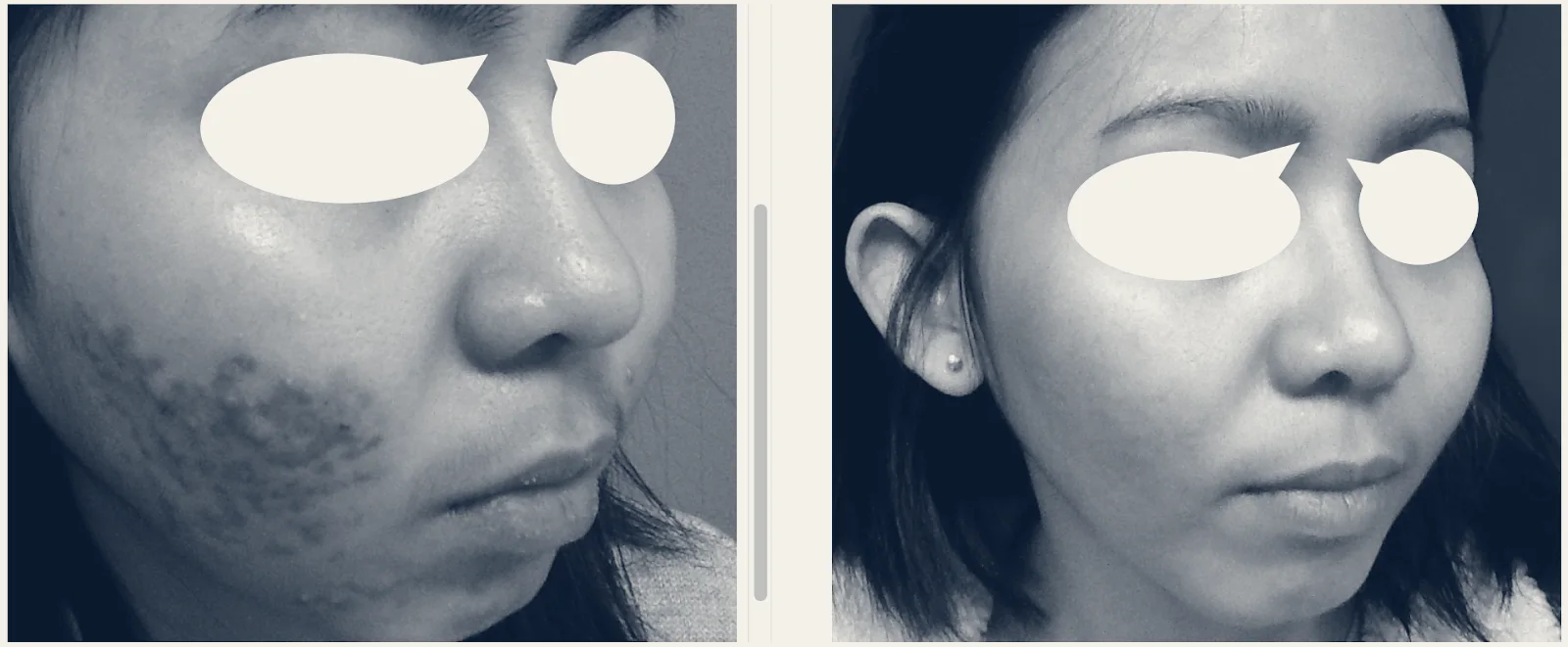 Boston Acne Specialists — Cambridge, Massachusetts