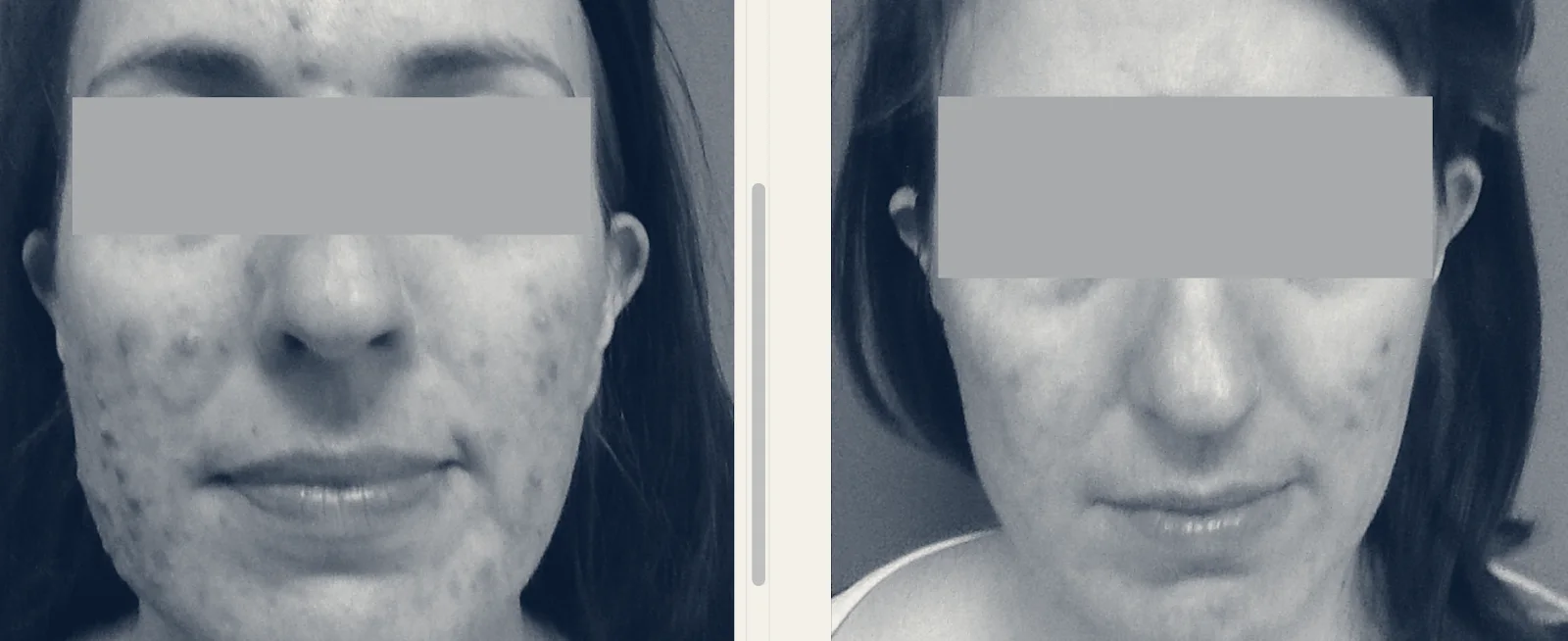 Boston Acne Specialists — Cambridge, Massachusetts
