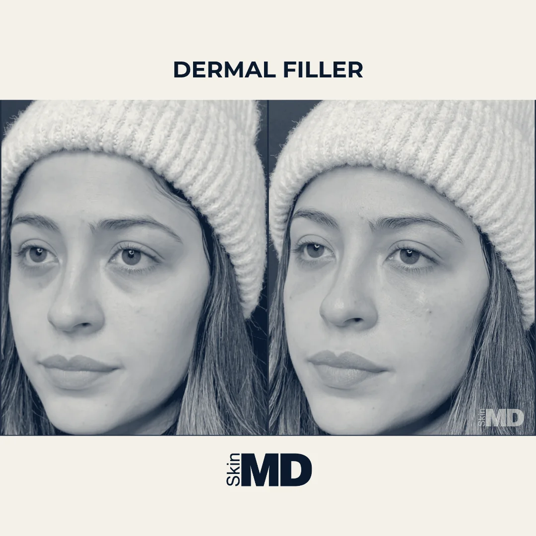 SkinMD Burlington — Burlington, Massachusetts