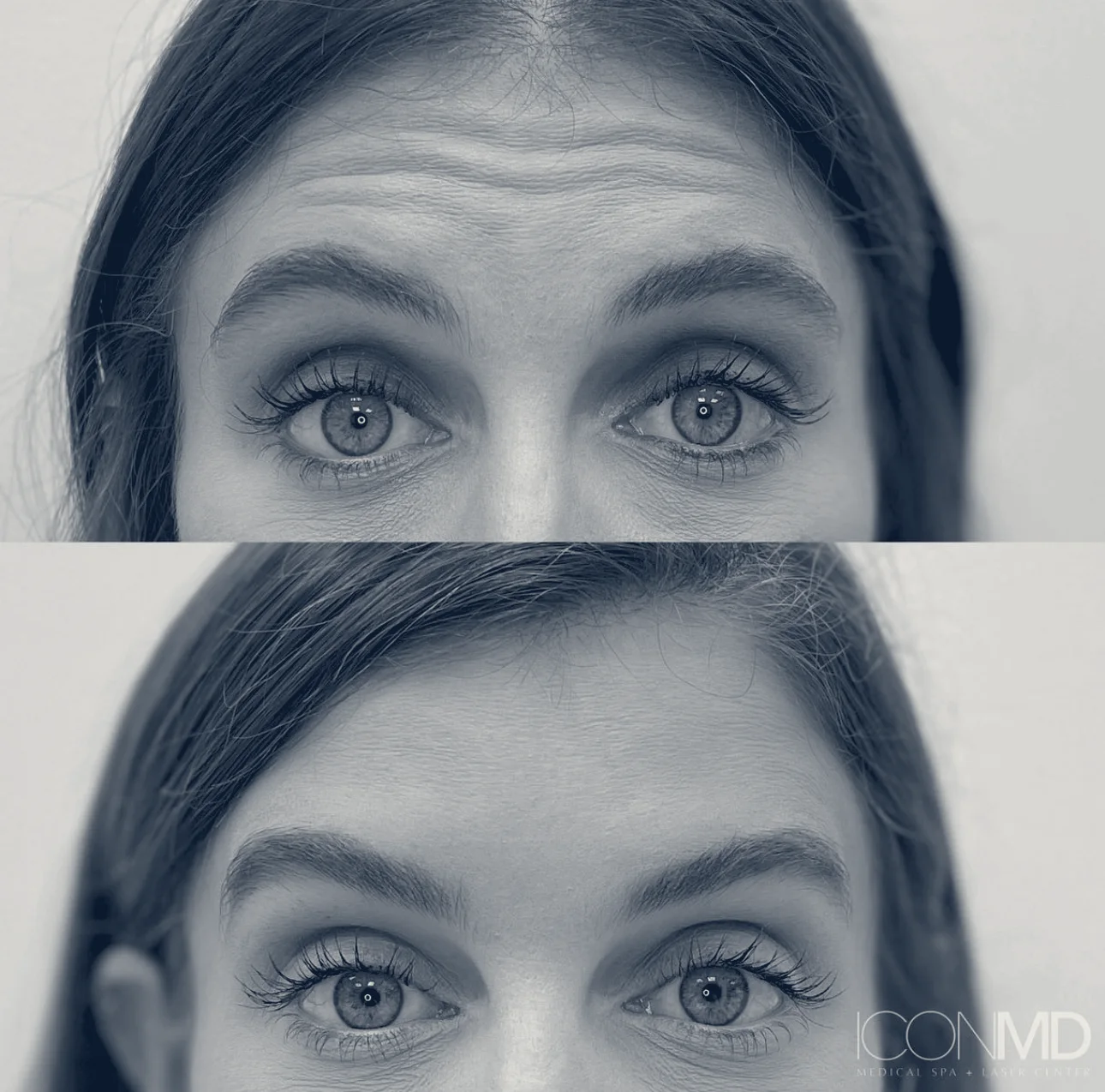 Icon MD Medical Spa + Laser Center Boston — Boston, Massachusetts