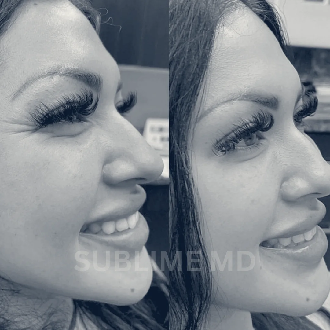 Sublime MD — Riverside, California
